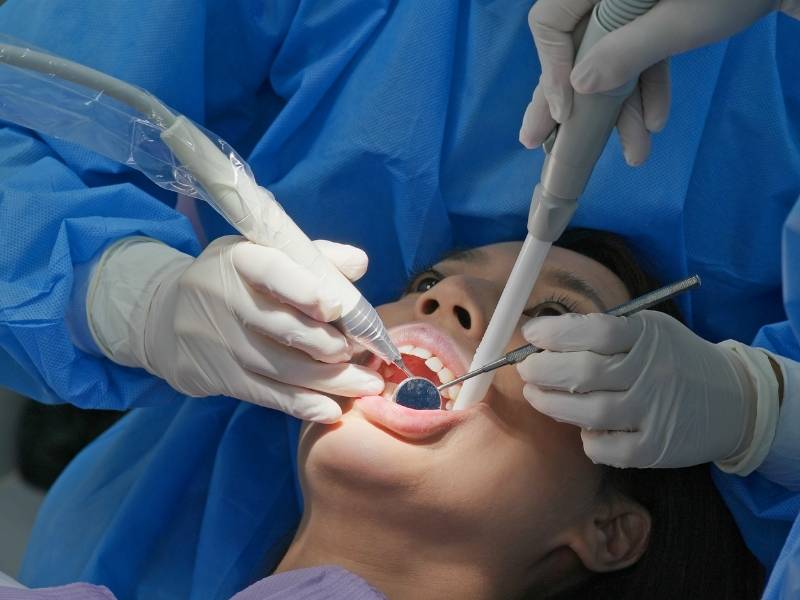 6 Manfaat Perawatan Scaling Dari Klinik Gigi Jakarta Barat